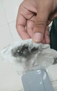 دستگاه بخور گرم و سرد پاکسازی پوست و صورت