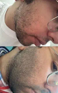 طناب بزن پرپشت بشه
