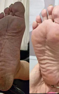 پدیکور و کف سابی پا