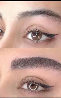 فیبروز ابرو