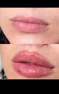 جشنواره بهاری کلینیک زیبایی و مراقبت پوستی سپیدار