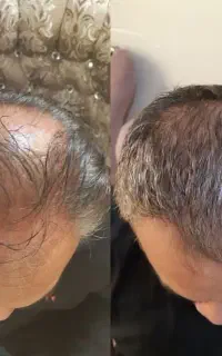 این اخرین روشیه که امتحان میکنی