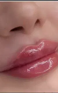 مدل جهت تزریق فیلر