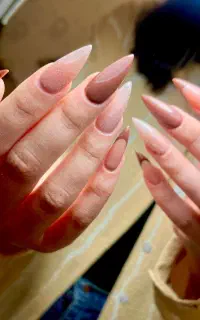 فرصت ویژه برای کاشت ناخن