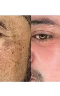 جشنوارتضمینی وتخصصی کک مک فقط تافردا /فقط در1جلسه