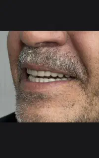 دندان سازی نیکو