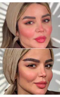 کاشت ابرو با متد میکروکاشت