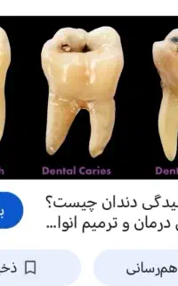 دندان