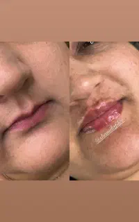 نیاز به مدل فیلر برای تکمیل البوم کاری