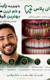 جشنواره ایمپلنت و کامپوزیت اقساط بدون پیش پرداخت