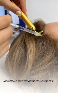 تخفیف ویژه بوتاکس پی ار پی مزوتراپی مزوژل لوکسیوا