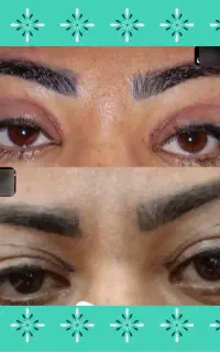 بلفاروپلاستی ۵/۵و تخفیفهای ویژه در جشنواره هفت روز