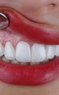 دندانپزشکی اقساطی با چک صیادی