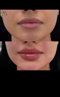 لیزر موهای زائد فول بادی ۸۹۰ ضمانت بازگشت وجه