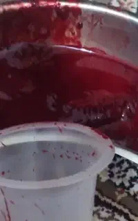 تزریقات و حجامت توسط پرستار با سابقه