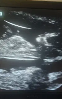 تایپیست خانم