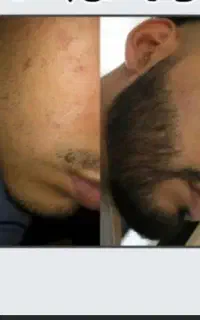 نهایتا ۱۹ روز دیگه کافیه تحمل کنی تا روش دار شی