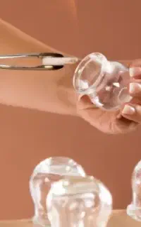 حجامت تخصصی توسط متخصص طب سنتی