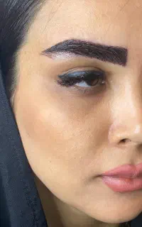 تخفیف ۱۲ میلیون تومانی کاشت ابرو،مو، مژه، بلفارو