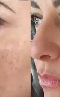 معجزه پوستت پیش منه