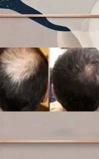 محافظ لنز رویش