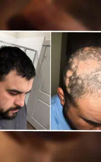 از فرش پر تراکم تر میشه