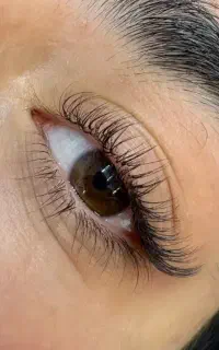 کاشت موقت واکستشن مژه