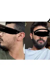 اصولی و دائمی پرپشتش کن