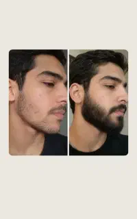 اصلی ترین نیاز یک مرد قطعا ریش و سبیله