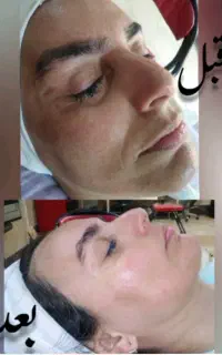 هدیه ای برای روز دختر تخفیف ویژه خدمات فیشال