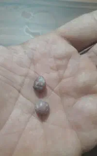 مهره جفت