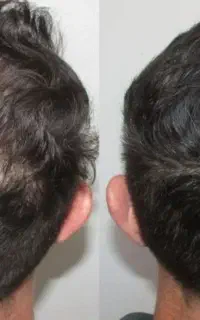 سیستم تقویتی