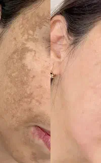 حذف کک ومک هادر۱جلسه ویژه بانوان