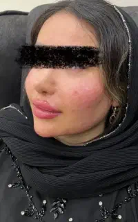 خدمات زیبایی الماس