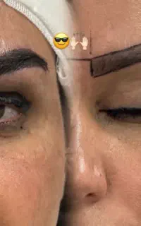 کاشت ابرو جشنواره ویژه