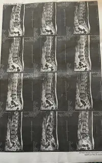 کاردرمانی ، فیزیوتراپی و طب سوزنی تخصصی