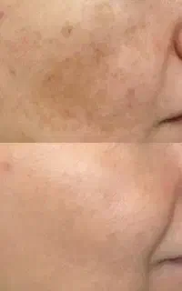 فرمول کرم اماراتی اصل
