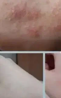 پاکسازی و جوانسازی پوست و صورت