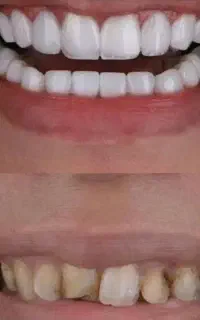 کلینیک دندانپزشکی پرلین زیبایی و درمانی