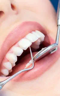 خدمات دندانپزشکی را با خیال راحت قسطی کنید