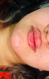 فیلروپیرسینگ وپی ارپی