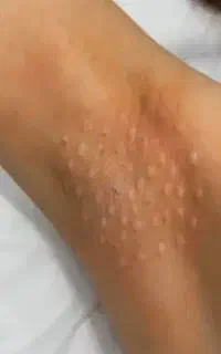 آموزش ژل بوتاکس  ناخن کاشت میکاپ مزو