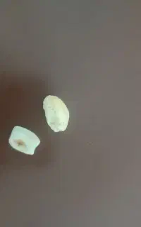 سنگ مهره