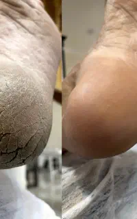 آموزش تخصصی پدیکور ( پردرآمدترین لاین زیبایی )