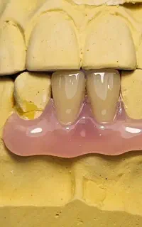 لابراتوار دندانسازی3dental