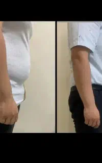 مرکز لاغری بدون برگشت
