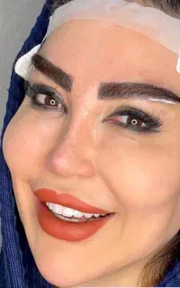 کاشت ابرو در خوزستان