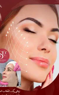 لیفت صورت با نخ (اقساط)