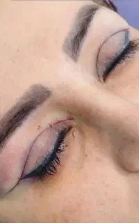 بلفاروپلاستی ،سانترال،دایرکت ابرو،کاشتvipجشنواره