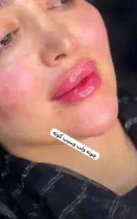 تخفیف ویژه ژل از ۱۷۰۰داریم به بالا